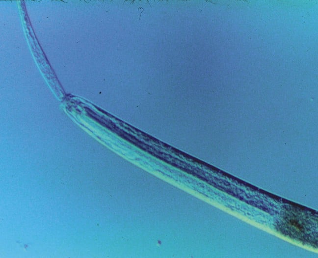 Predatory nematode eating another nematode