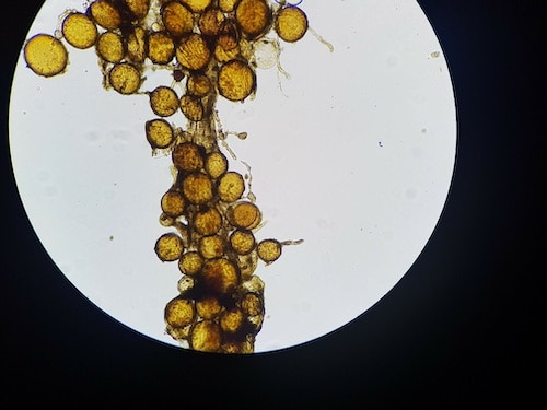 Ectomycorrhizal spores colonizing a root blade